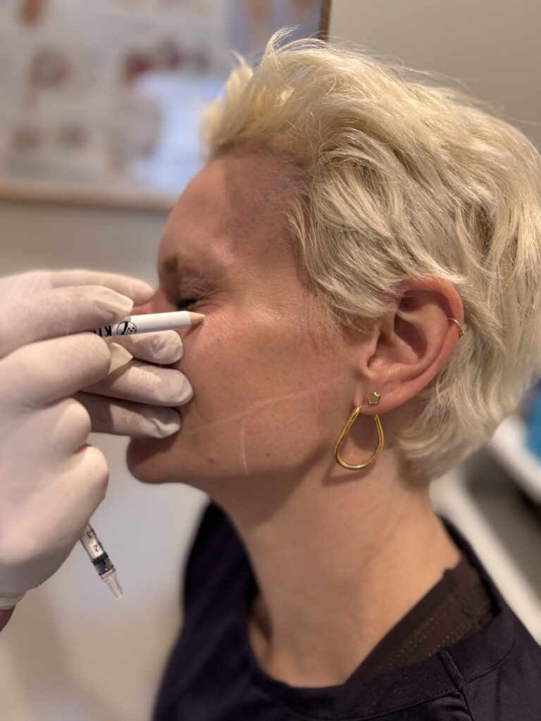 Migrene, kjeveplager og overdreven svette – årsaker og behandling 1 Markering av massetermuskelen ved vurdering av kjeveplager